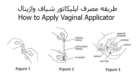 How to apply vaginal suppository applicator طریقه مصرف اپلیکاتور شیاف واژینال